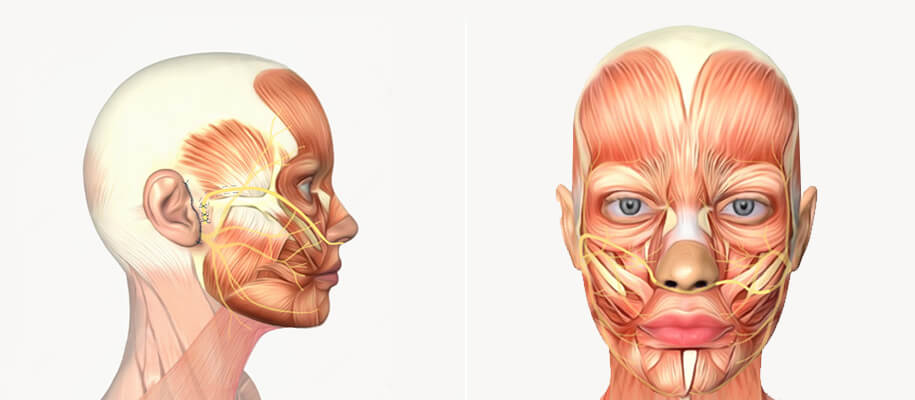 how-is-cross-facial-nerve-graft-procedure-done.jpg (33 KB)